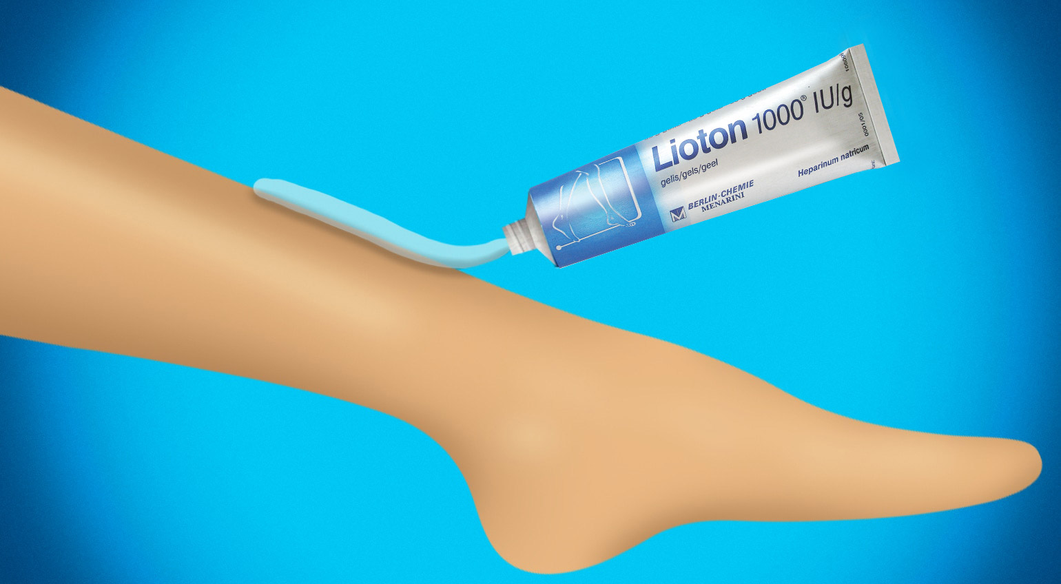 Lioton® 1000 gelio tepimas ant apsunkusios kojos